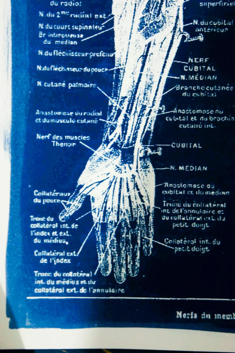 Cyanatomy - Bras A4, art gothique original (3)
