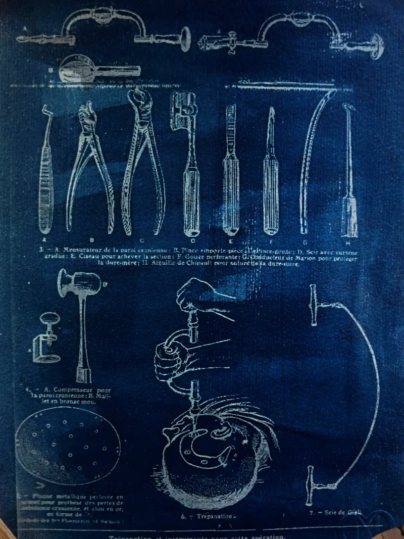 Cyanatomy - Trépanation A4, original gothic art (2)