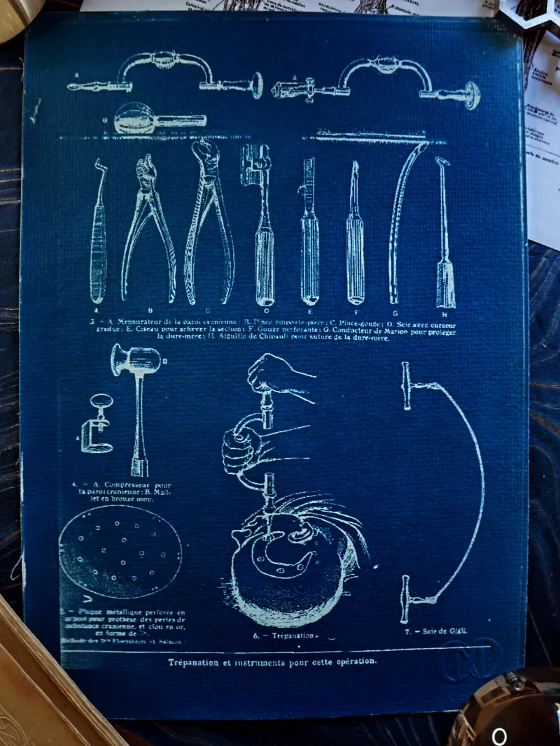 Cyanatomy - Trépanation A4, original gothic art