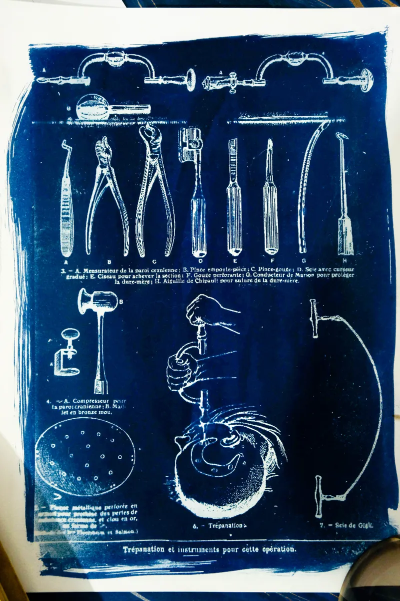 Cyanatomy - Trépanation A4, art gothique original (2)
