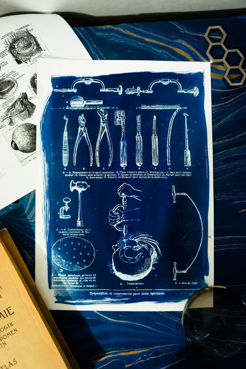 Cyanatomy - Trépanation A4, art gothique original