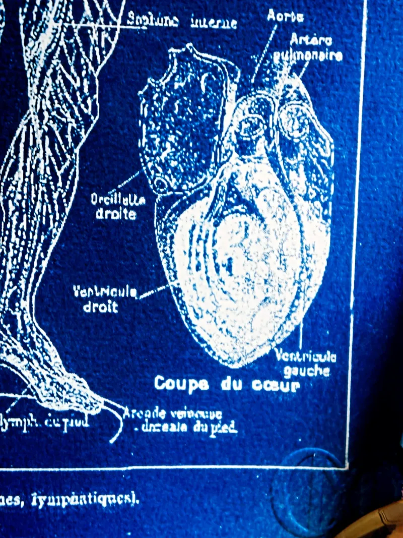 Cyanatomy - Sang et Lymphe A4, original gothic art (3)