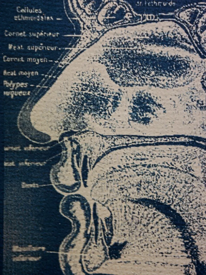 Cyanatomy - Nez A4, original gothic art (3)