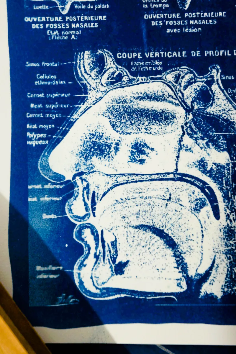Cyanatomy - Nez A4, art gothique original (3)
