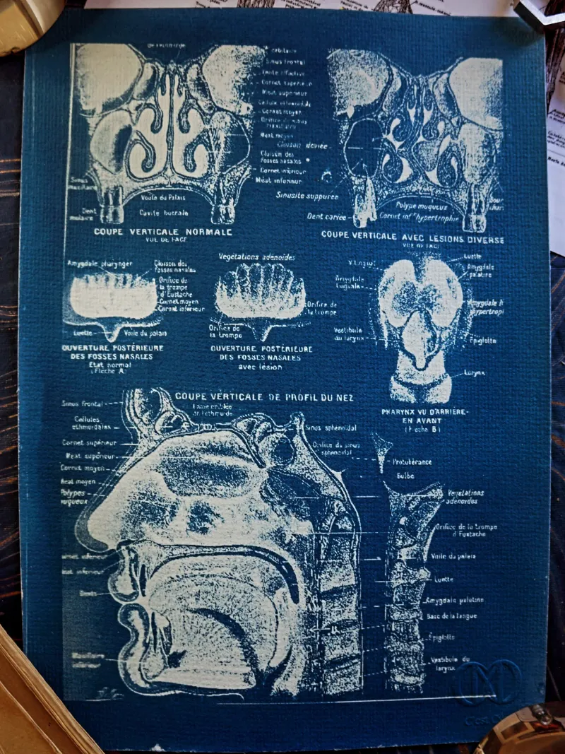 Cyanatomy - Nez A4, original gothic art