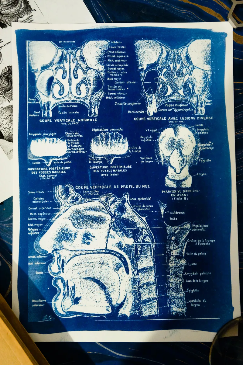 Cyanatomy - Nez A4, art gothique original (2)