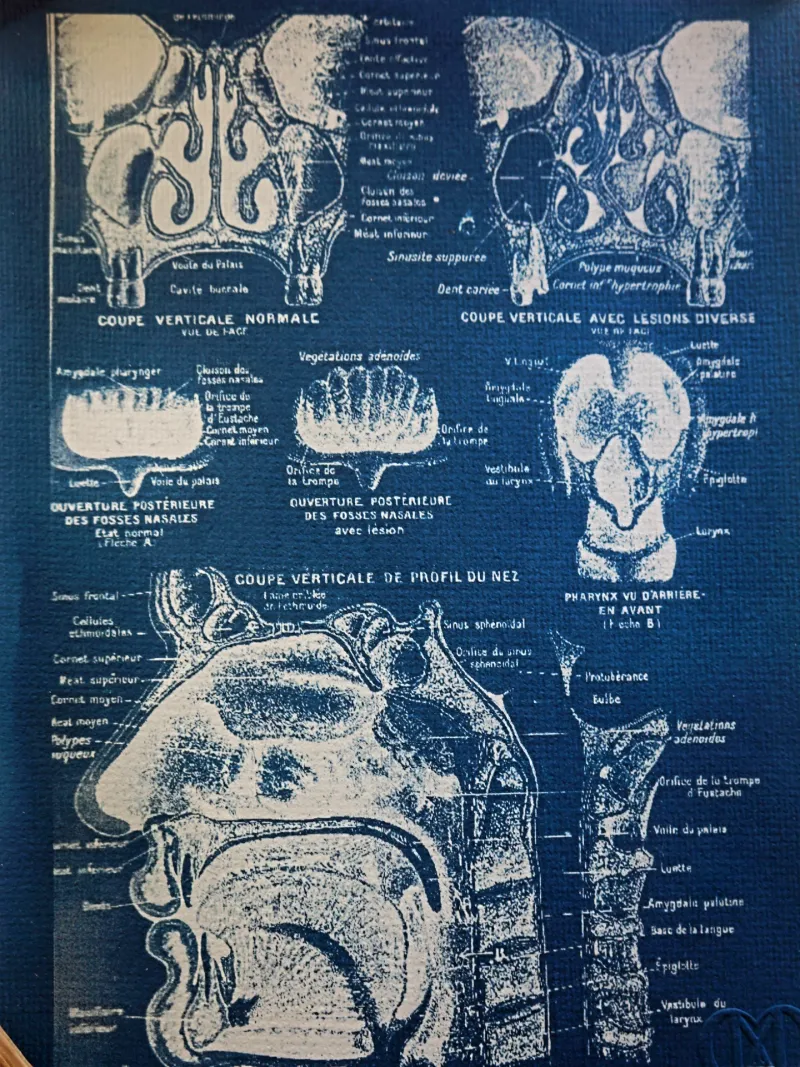 Cyanatomy - Nez A4, original gothic art (2)