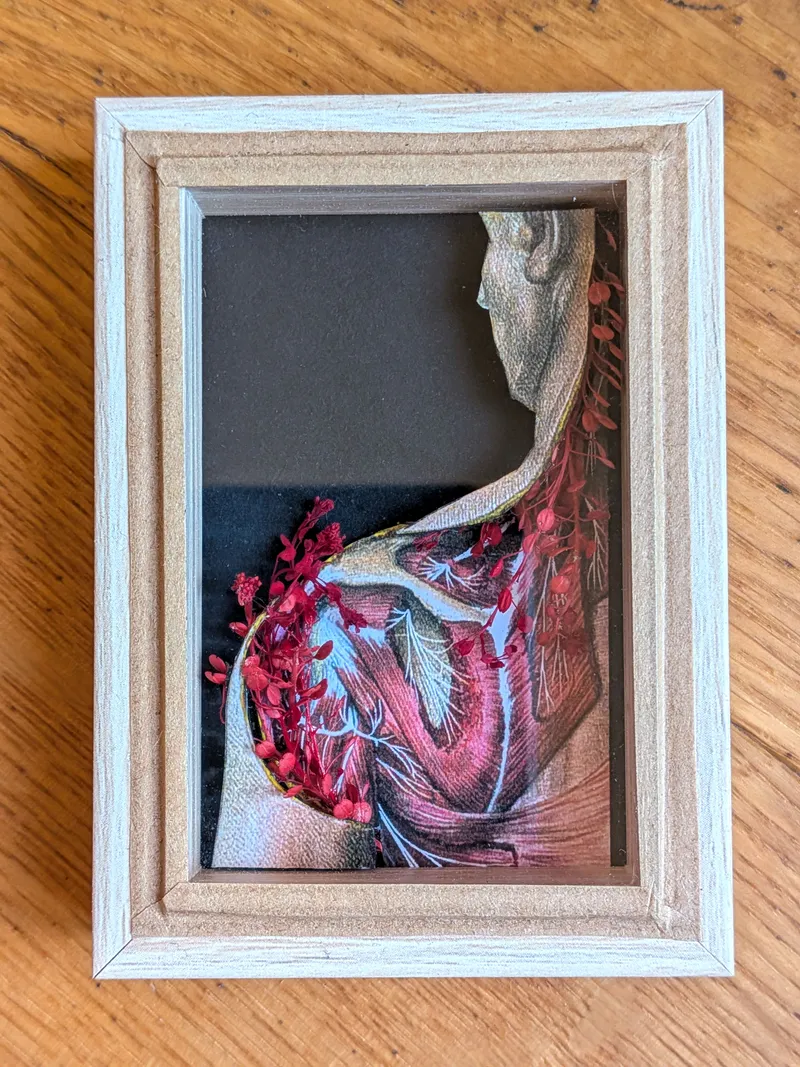 Miniature illustration médecine - Gravure ancienne - Les écorchés, original gothic art
