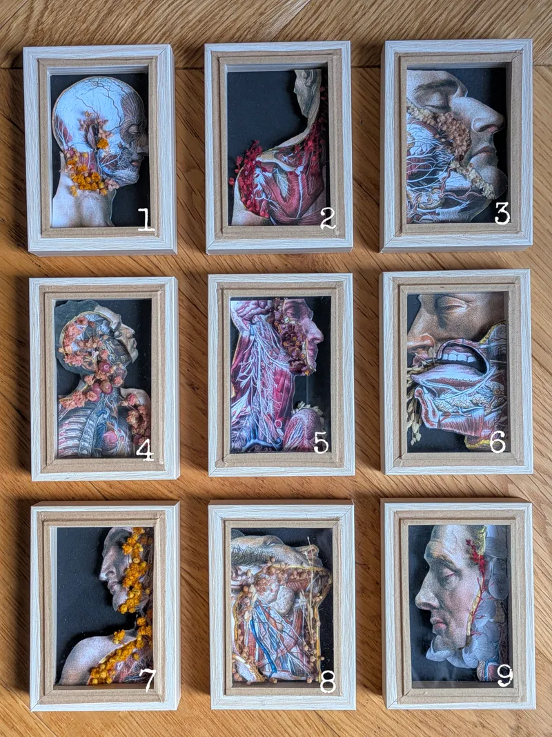 3 Miniatures avec illustration médicale ancienne - Gravure reproduction - Les écorchés, art gothique original (2)